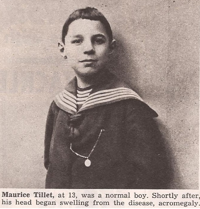 Look Magazine Apri 25 1950 – Maurice Tillet 13